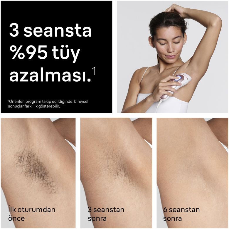 Braun Ipl Skin I·expert, Evde Lazerle Tüy Alma, App Ile, Mini Yüz Tüy Alma Cihazı, 4 Başlık, Pl7432