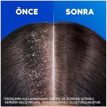 Diğer 57855210110912080184975 & Shoulders Limon Ferahlığı Kepek Karşıtı Yağlı Saçlar İçin Günlük Kullanım 330 Ml Şampuan
