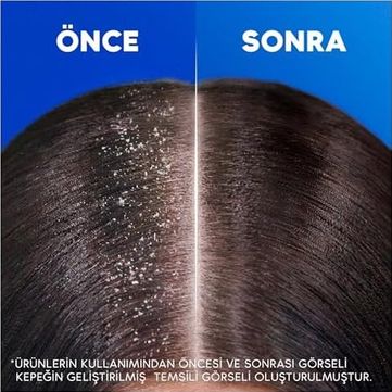 Diğer 57855210110923580184975 & Shoulders Klasik Bakım Kepeğe Karşı Etkili Şampuan 800Ml