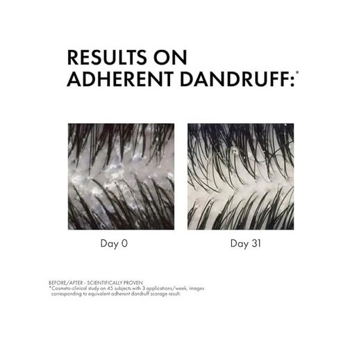 Diğer 57858324444692099283959 Vıchy Dercos Anti Dandruff Kuru Saçlar İçin Kepek Karşıtı Şampuan 200 Ml