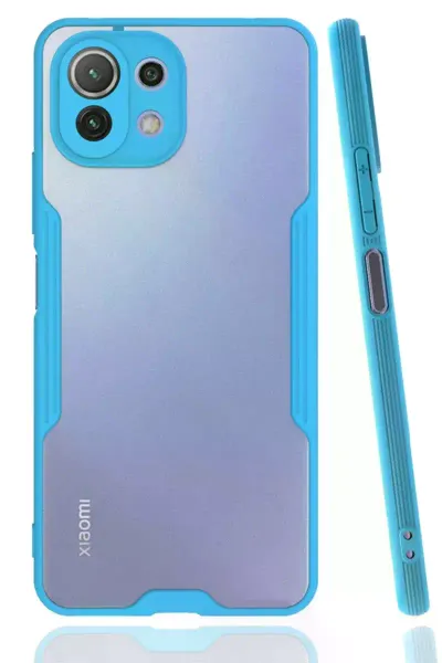 Xiao Mİ 11 Lite Kılıf Platin Silikon - Mavi