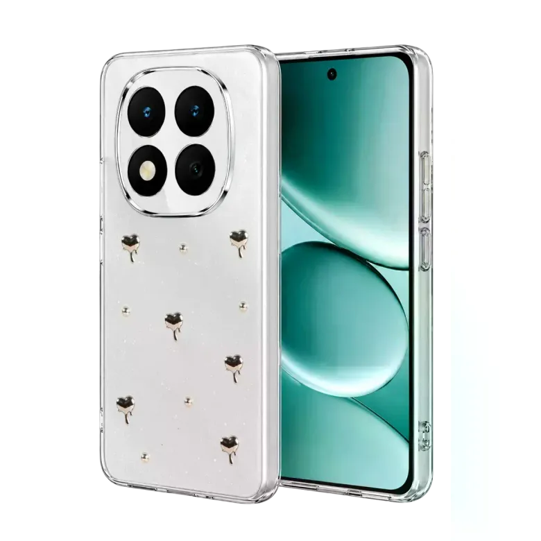Xiaomi Redmi Note 15 4g Fiyonk Desenli Kapak - Desen 1