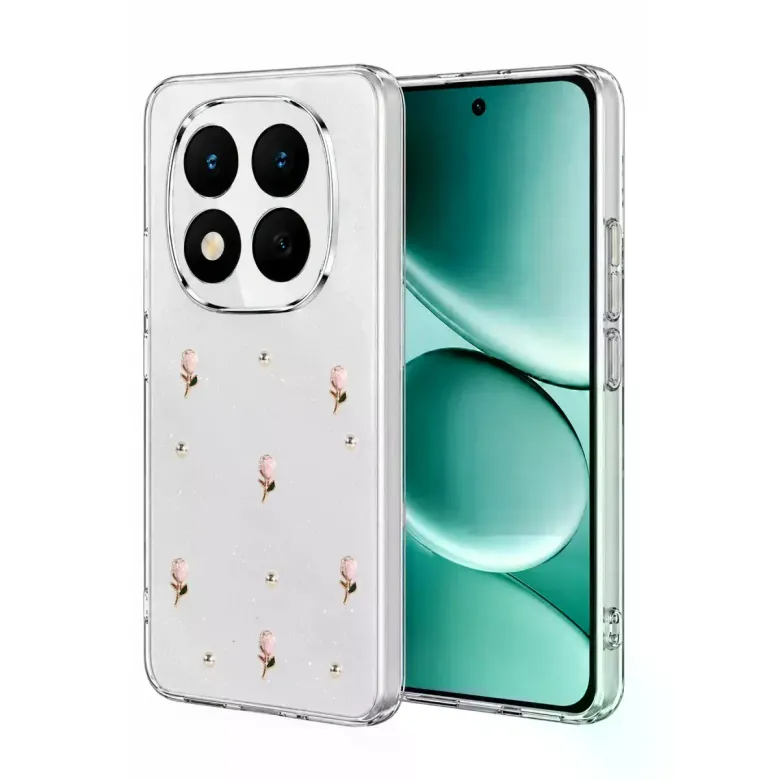 Xiaomi Redmi Note 15 Pro 5g Fiyonk Desenli Kapak - Desen 6