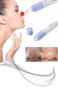 YNT İthalat RT-71 Pore Cleaner Vakumlu Yüz Temizleme Siyah Nokta Temizleme Cihazı