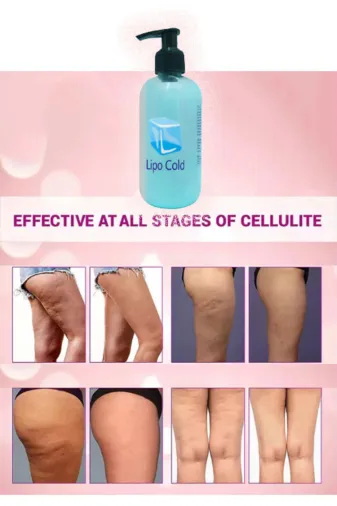 Balance Life GU-EYF-22759-BLN Lipo Cold Fazlalaşan Yağlarınızdan Ve Selülitlerinizden Kurtulmaya Karşı Krem 250 Ml