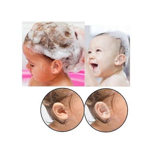 Diğer 562741420207 Bebek Banyo Kulak Koruyucu Bant 10 Adet