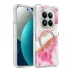 Onegif Xiaomi Redmi Note 15 4g Lotus Simli Magsafe Kapak - Pembe 1
