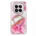 Onegif Xiaomi Redmi Note 15 Pro Plus 5g Lotus Simli Magsafe Kapak - Pembe 3