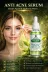 tulip life antiacne1 Anti Acne – Salicylic Acid 2% & Niacinamide – Pore Tightening & Oil Control 30 Ml 1