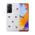Xiaomi Redmi Note 11 Pro Fiyonk Desenli Kapak - Desen 3 1