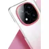 Xiaomi Redmi Note 14 Pro 5g Glossy Kapak - Siyah 3