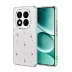 Xiaomi Redmi Note 15 4g Fiyonk Desenli Kapak - Desen 6 1