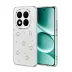 Xiaomi Redmi Note 15 Pro Plus 5g Fiyonk Desenli Kapak - Desen 2 1